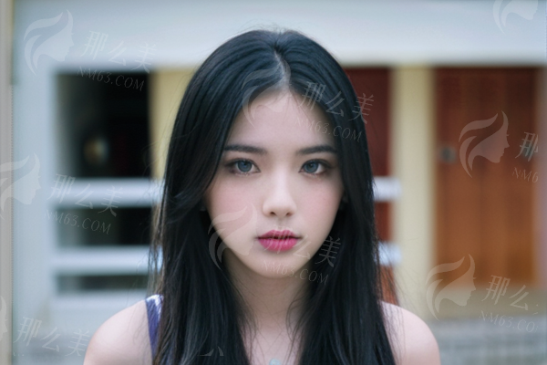 温州艺启美整形医院双眼皮