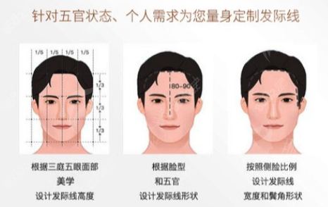 江苏百年植发医生团队与植发技术 江苏百年植发医生团队与植发技术