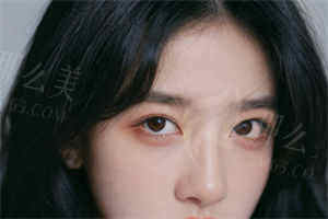 吸脂.jpg