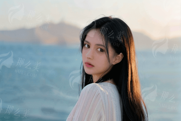 遂宁西西整形鱼尾纹/眉间纹除皱、中上面部除皱效展示