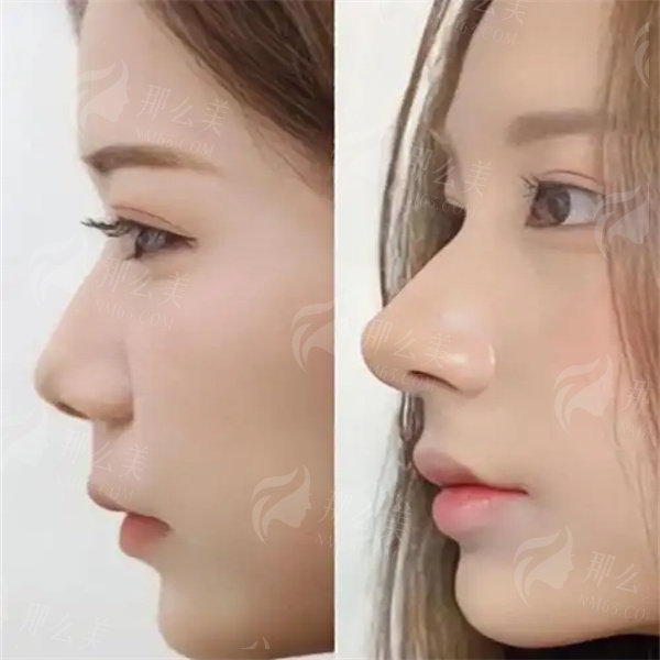 1750236639340880.jpg u=815399397,1527436315&fm=253&fmt=auto&app=120&f=JPEG.jpg