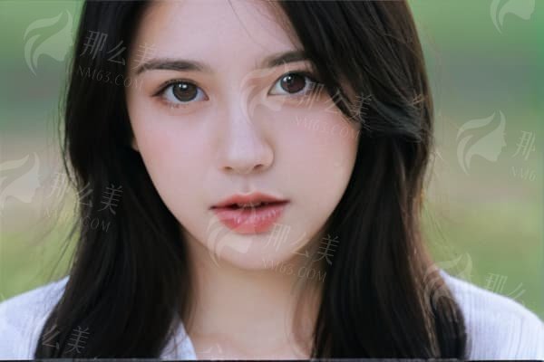 上海伊莱美整形下颌角整形反馈与费用：鹅蛋脸蜕变实录，性价比公开