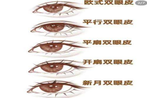 二、上海华 山医院丁志医生双眼皮有哪些独门技术?