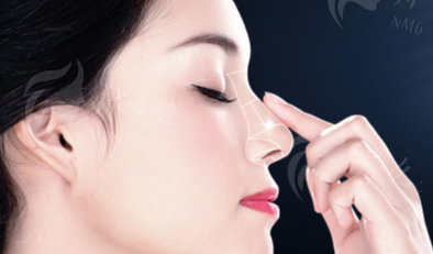 三、广州同城肋软骨隆鼻价格大公开