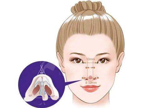 四、南京隆鼻怎么避坑?预约攻略来了