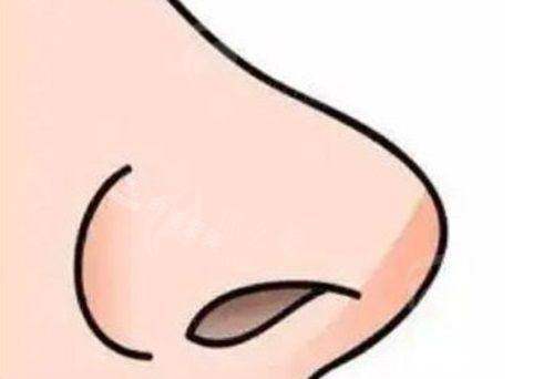 四、什么样的人适合做肖强肋软骨隆鼻?