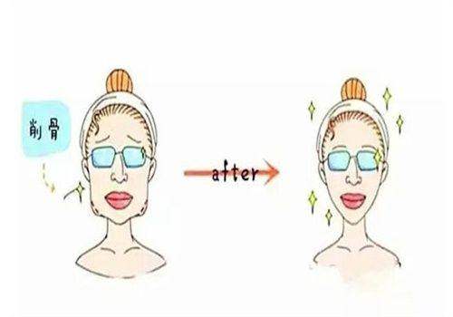 一、重庆星荣刘正茂做颌面整形技术到底强在哪？