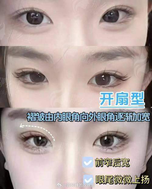 四、重庆vs昆明：眼部整形医院怎么选？