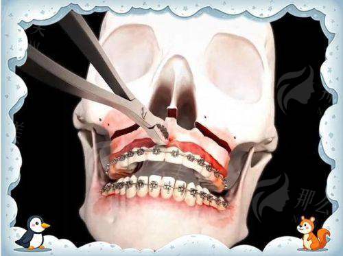 三、真人实例分享：方脸妹的逆袭日记