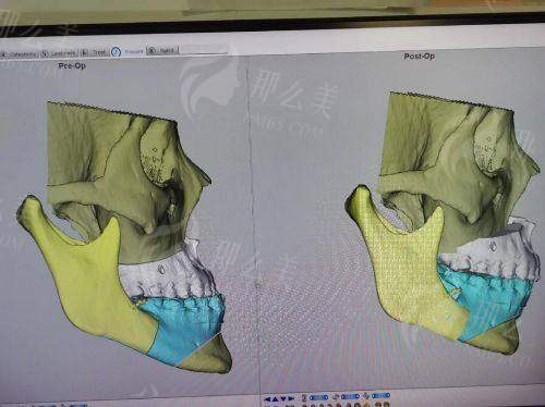 四、重庆星荣刘正茂预约指南