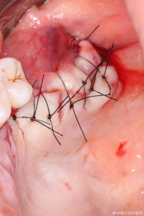 二、重庆星荣颌面整形2024价格表曝光