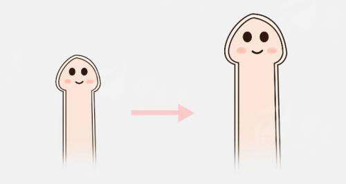 三、阴茎弯曲矫正术前术后要注意什么?