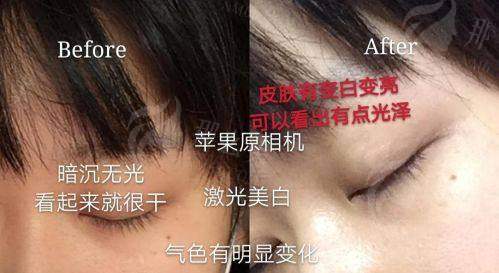 二、南京金铂利口腔的隐形矫正值得选吗?