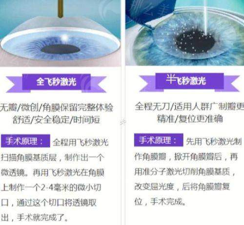 一、温州华厦眼科飞秒激光手术技术怎么样?