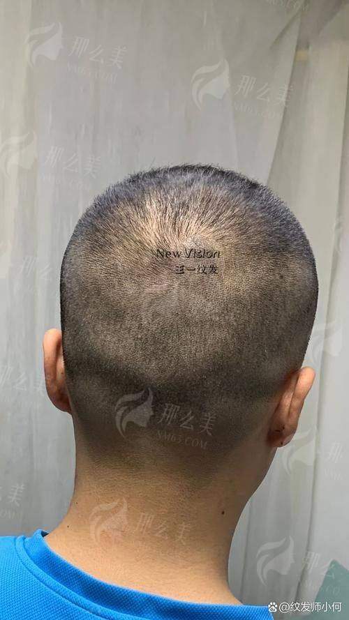 一、青岛星尚植发张素英医生是谁?专精背景大起底