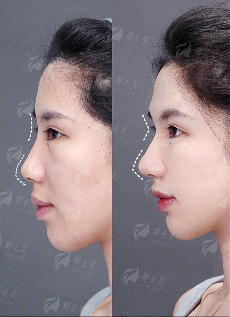 二、苏州沐兰清颜幼态脸打造有哪些独门技术？