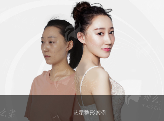 二、北京艺星医疗美容医院怎么样?项目价格与服务质量分析