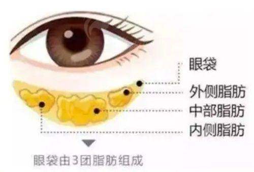 三、苏州美莱祛眼袋的价格贵吗?同城项目价格对比