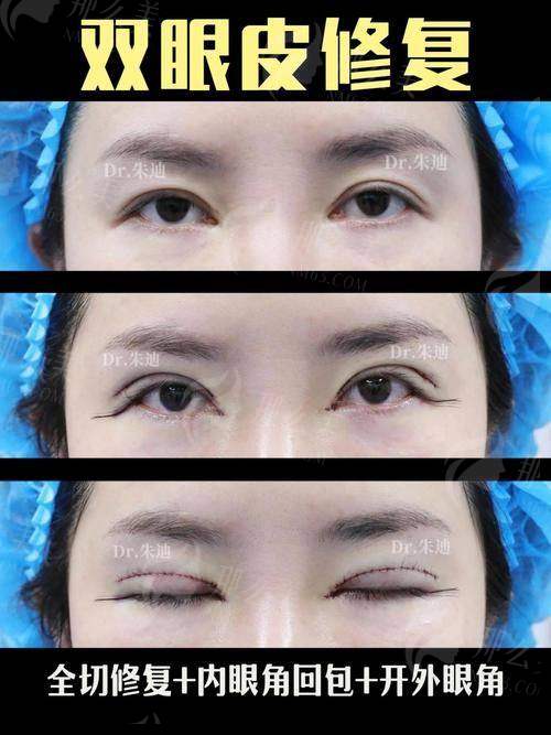 四、北京英煌整形医院环境及服务质量