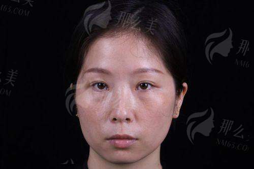 四、苏州美莱美容医院如何预约于加平、吴静医生?