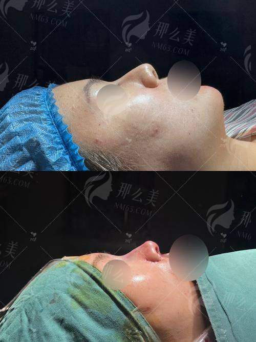 一、朱洪涛隆鼻修复技术到底强在哪?