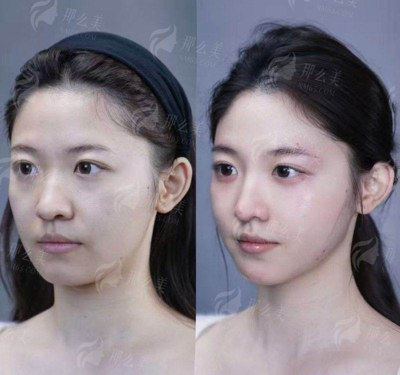 二、惠州市稚美医疗美容怎么样的核心技术优势解析