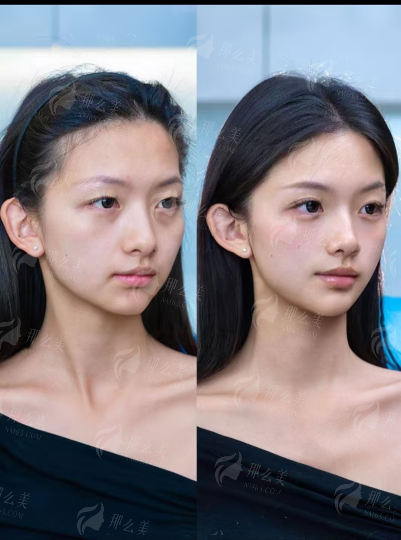 二、重庆美莱医生技术强在哪?认准这两个证!