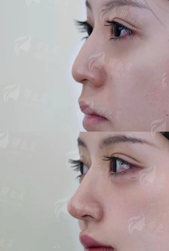 四、怎么预约朱洪涛面诊?收好这份攻略