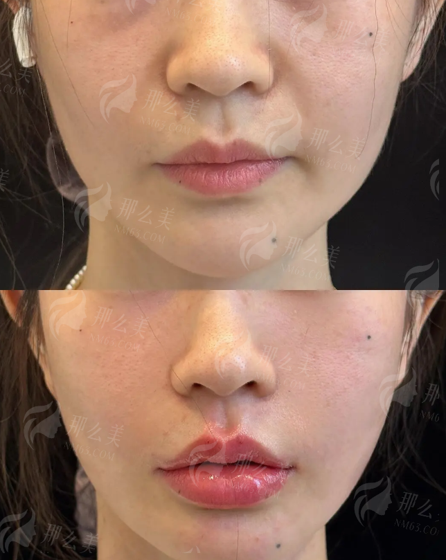 三、青岛韩艺美整形医院怎么样?价格收费透明吗?