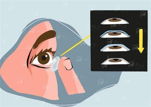 梅州爱明眼科医院：服务贴心，环境舒适