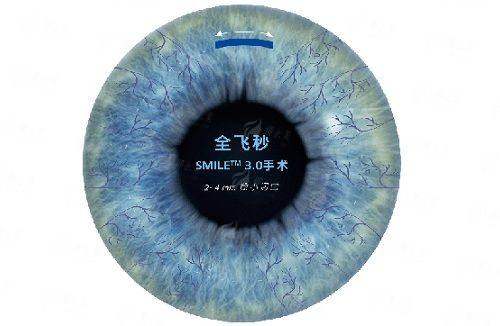 梅州爱明眼科医院：患者好评如潮