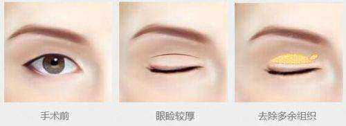 二、杭州爱琴海医疗美容门诊部（杭州整形医院国内外部）怎么样？王牌项目与价格参考