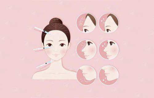 五、温州丽星医疗美容门诊无创祛斑常见问题解答