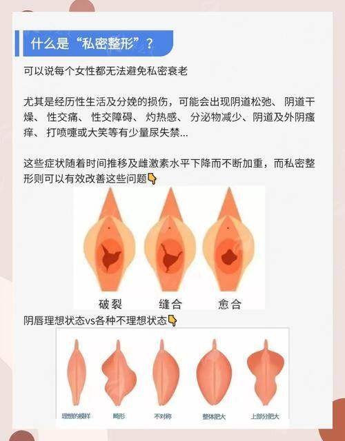 二、西安慈爱医院黄静医生做处女膜修复手术技术怎么样?