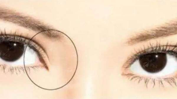 二、西安国际医学整形医院付丹凤医生私密整形价格表公开