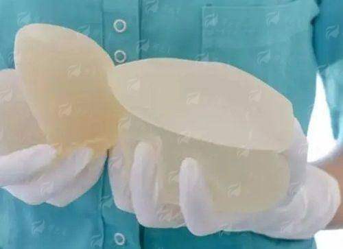 三、苏州铂蔓富贵包整形的真人实例成效如何？