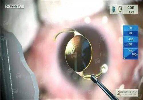 为什么选择大连爱尔眼科医院？