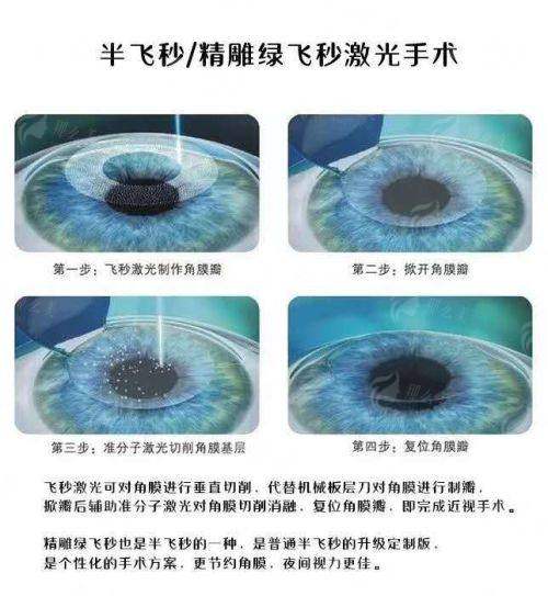 甘肃爱尔眼视光医院的公益项目
