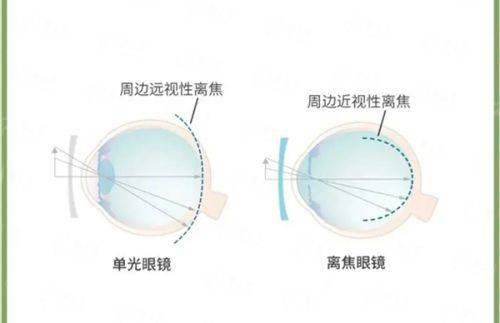 长春爱尔眼科医院技术优势:精细医疗,国内外同步