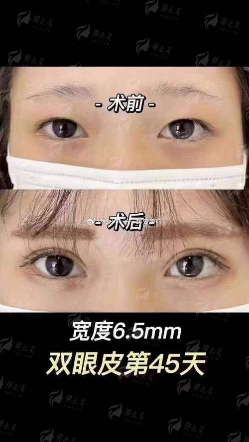 四、临汾美特尔整形预约张兆博医生有哪些方式？实地探院指南