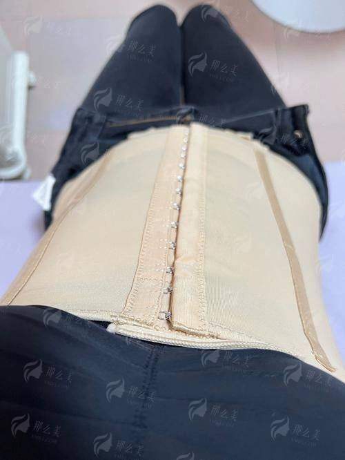 二、郑州缔莱美面部吸脂用的什么黑科技？