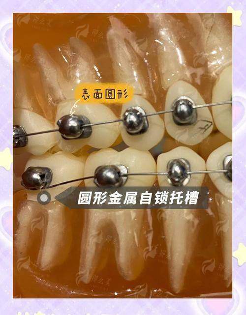 四、深圳汇港口腔如何选择与预约？