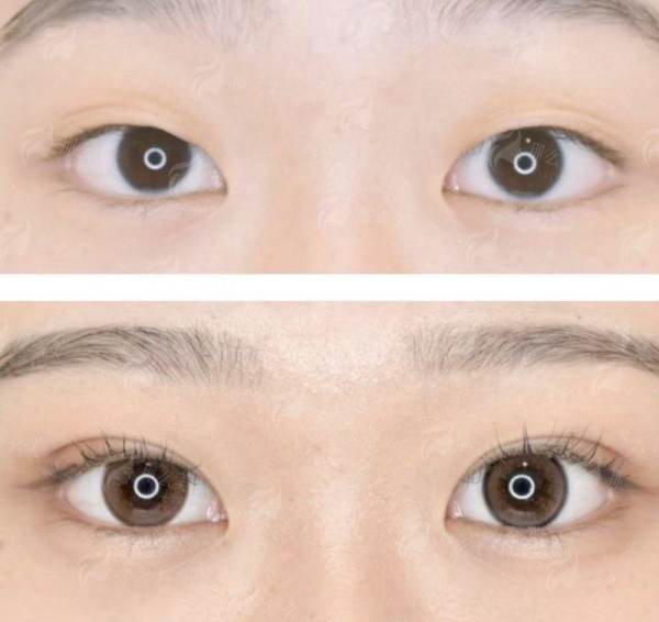 四、上海韩卓预约避坑指南