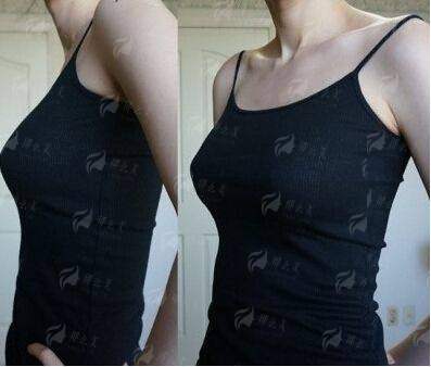 三、苏州薇琳美容医院内窥镜隆胸收费贵不贵？