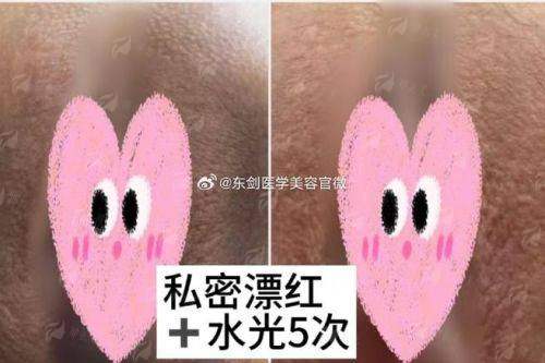 四、惠州惠城友禾私密科的价格和预约方式