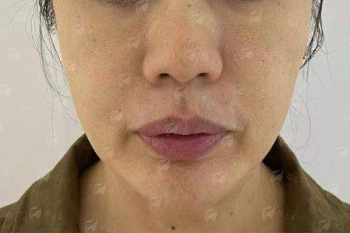 二、宁波拾壹逐光馒化修复有哪些黑科技？