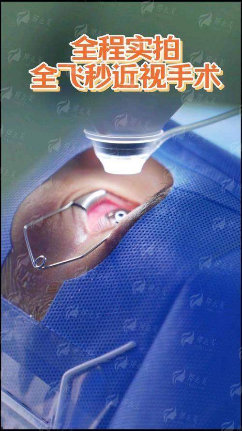 四、武汉阿玛施眼科门诊如何预约全飞秒手术?