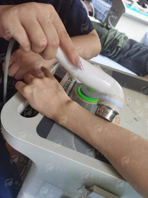 二、西安赫本医疗超声炮价格贵不贵？值不值得做？