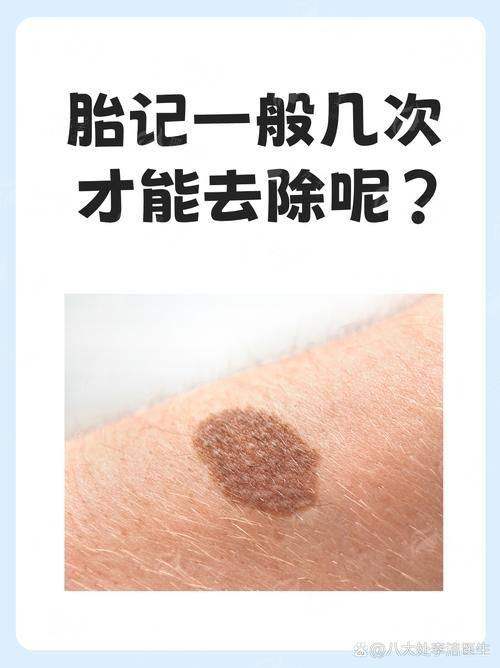 四、同城对比!为什么选北京广济医院疤痕科?