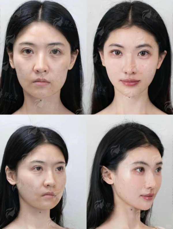 三、广州可玉医疗美容的医生靠不靠谱?